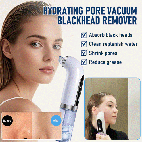 GlowSculpt - Hydrating Pore Vacuum Blackhead Remover