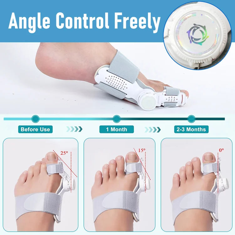 AlignToe Bunion Corrector for Women & Men