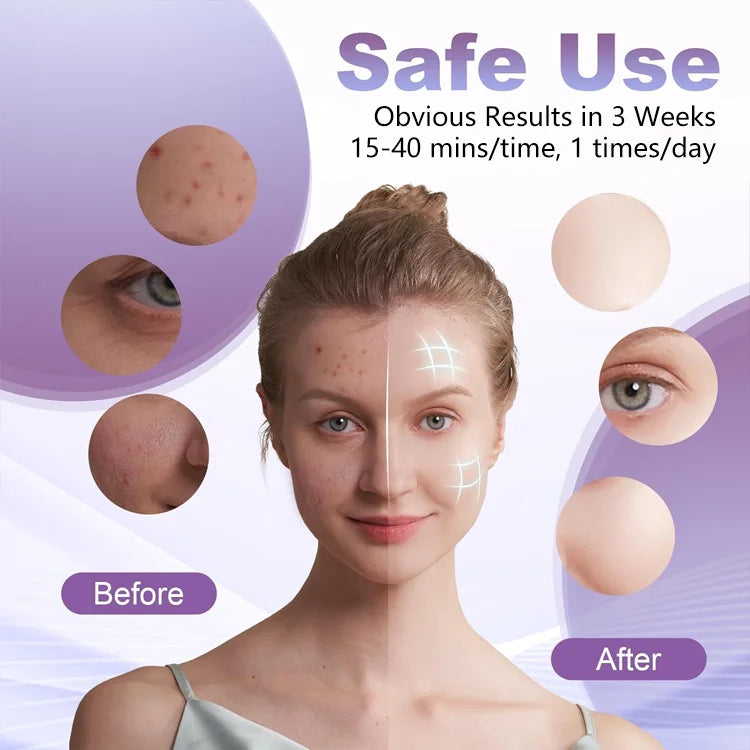 RejuvaLight 7-Color LED Face Mask