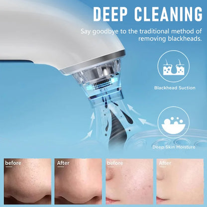 GlowSculpt - Hydrating Pore Vacuum Blackhead Remover