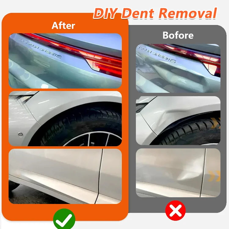 GripEase - Super Strong Suction Cup Dent Remover(L + XL Combo Set)