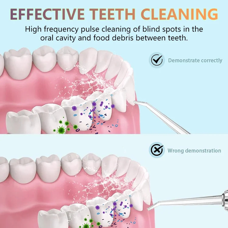 HydroFloss Pro Cordless Water Flosser – Dentist-Level Clean at Home