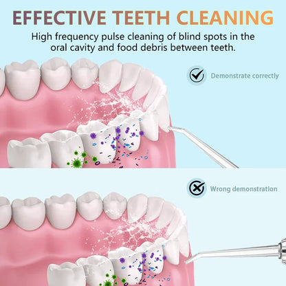 HydroFloss Pro Cordless Water Flosser – Dentist-Level Clean at Home