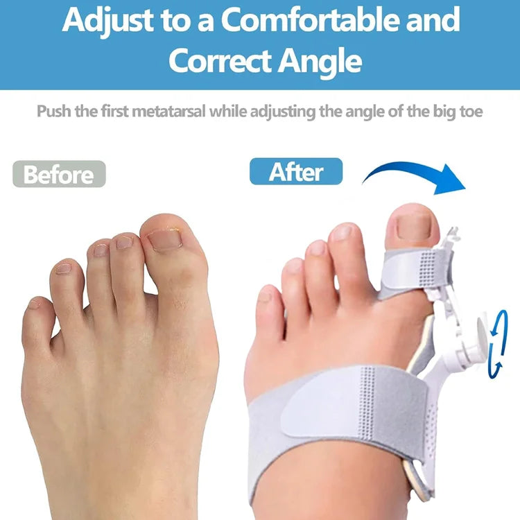 AlignToe Bunion Corrector for Women & Men