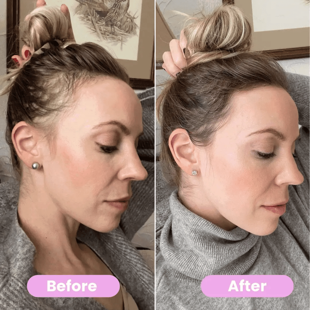 3-in-1 Scalp Massaging Red Light Therapy Brush