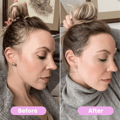 3-in-1 Scalp Massaging Red Light Therapy Brush